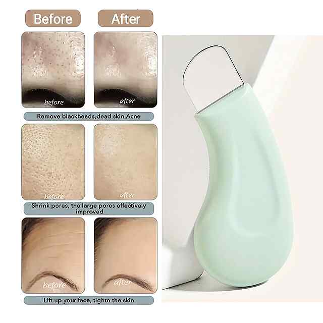Інструмент для видалення чорних крапок — очищення пор, безпека та комфорт. - 0 фото товару