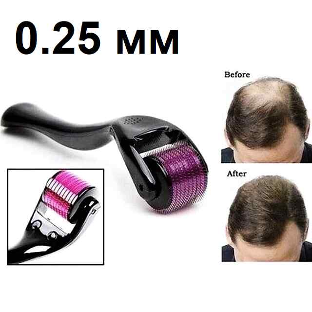 Мезоролер 540 голок: Зменшення зморшок, стимуляція колагену та глибоке проникнення сироваток. Догляд за обличчям і тілом.