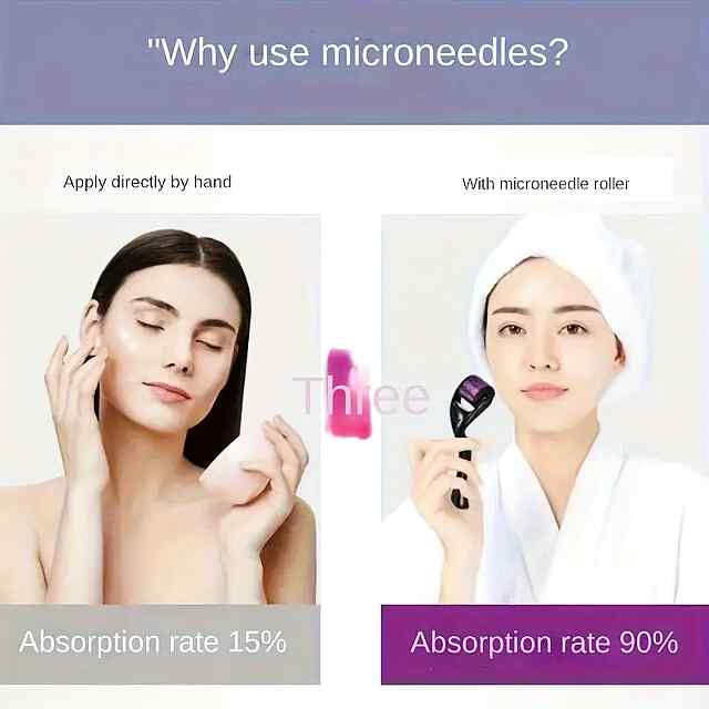 Мезоролер 540 титанових голок – омолодження та відновлення шкіри - 3 фото товару