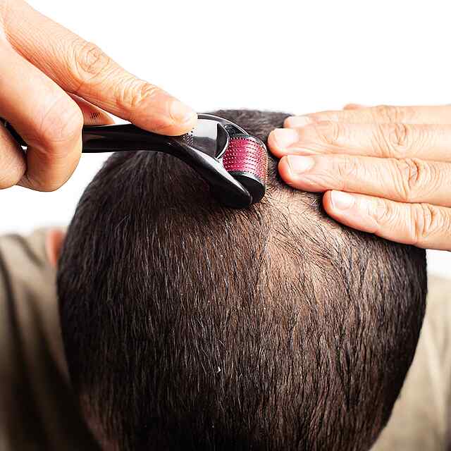 Мезоролер на 540 голках - омолодження та відновлення шкіри, інноваційний догляд за обличчям. - 0 фото товару