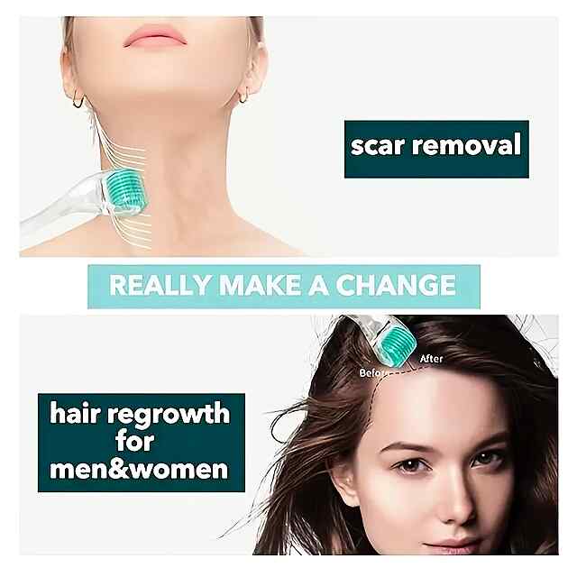 Мікроголковий мезоролер (дермароллер) для обличчя та бороди 0.25 мм, 192 голки. Титан. Догляд волосся - 1 фото товару